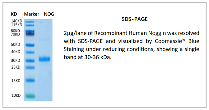 OrganRegen-Recombinant Human Noggin（807-NOG）